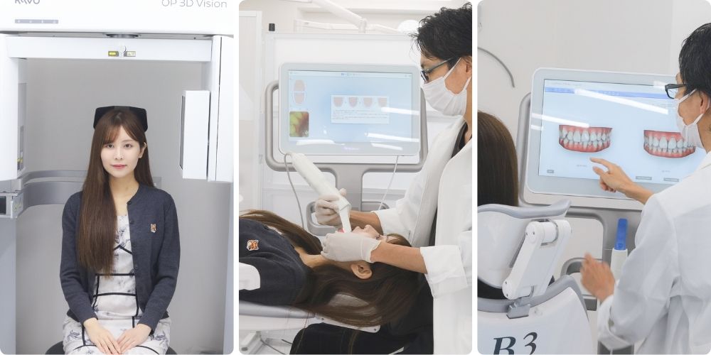 キレイライン矯正の初回検診ですること