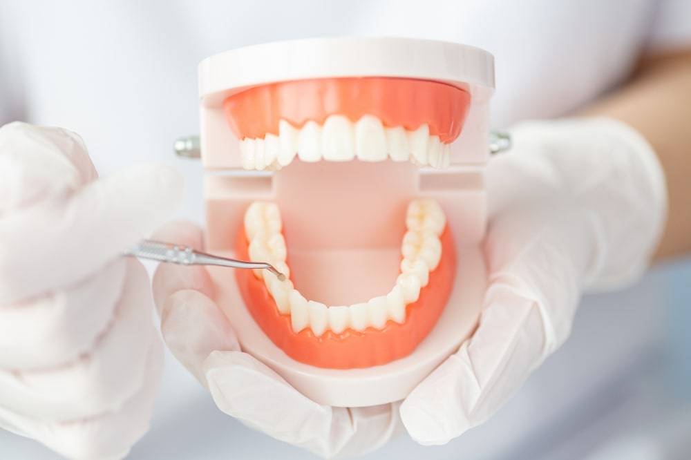 歯科衛生士と歯型模型