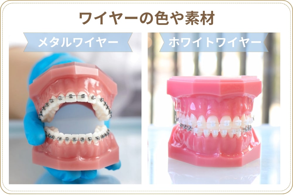 ワイヤーの色や素材の種類