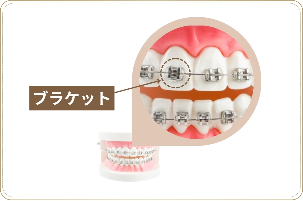 ブラケットの種類