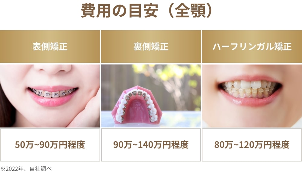 ワイヤー矯正の種類ごとにかかる治療費用