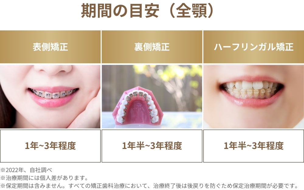 ワイヤー矯正の種類ごとにかかる治療期間