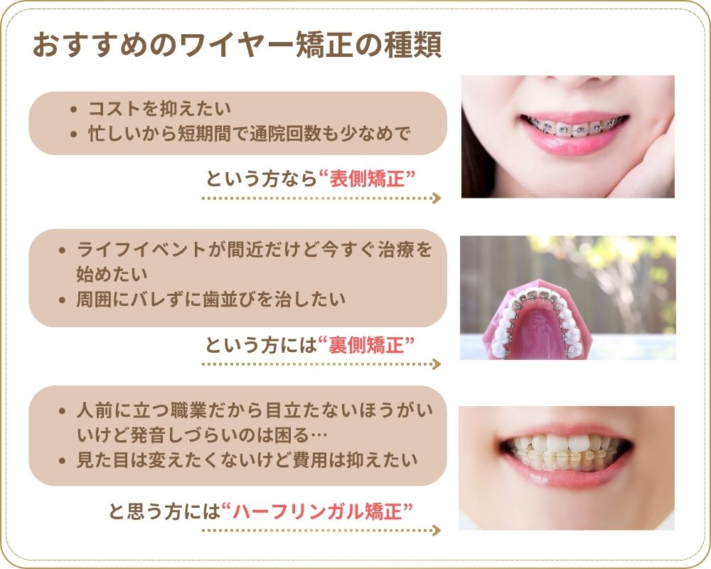 おすすめのワイヤー矯正の種類