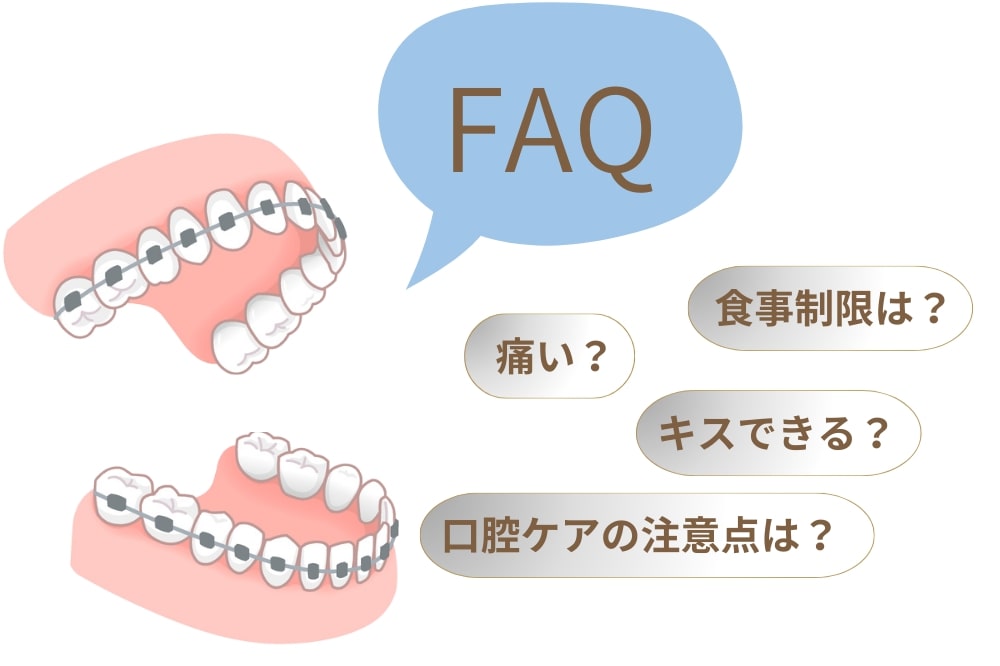 ワイヤー矯正の疑問を解消！