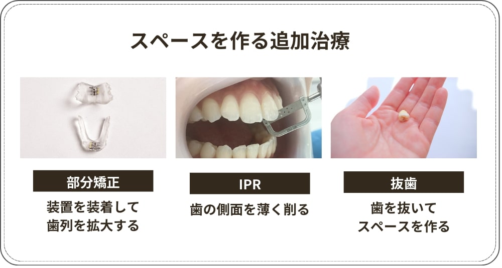 スペースを作る追加治療