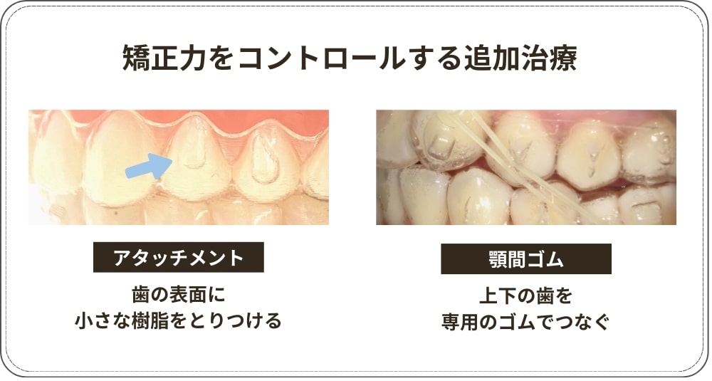 矯正力をコントロールする追加治療