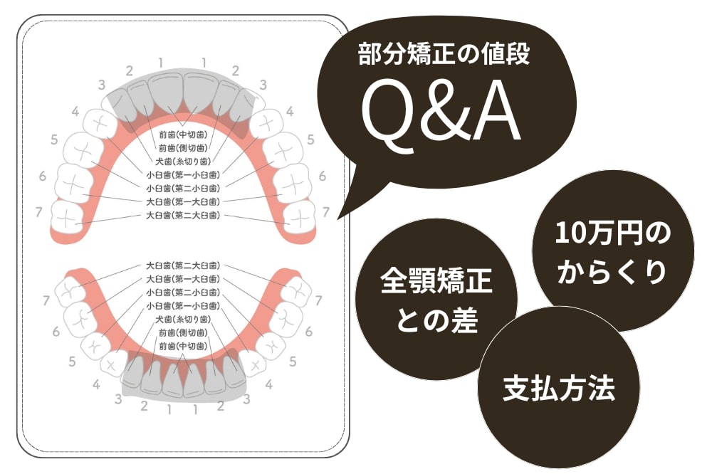 【Q&A】部分矯正の値段にまつわる疑問を解決