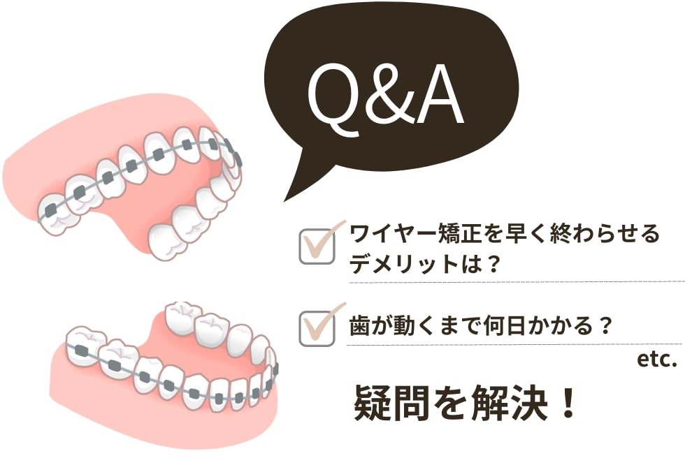 ワイヤー矯正の治療期間にまつわるQ&A