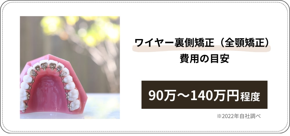 ワイヤー裏側矯正（全顎矯正）の費用の目安