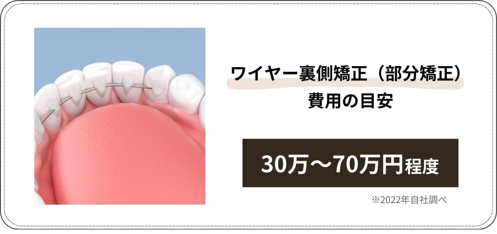 ワイヤー裏側矯正（部分矯正）の費用の目安