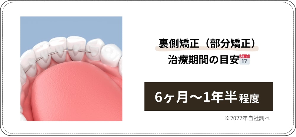 裏側矯正の期間を短縮する方法