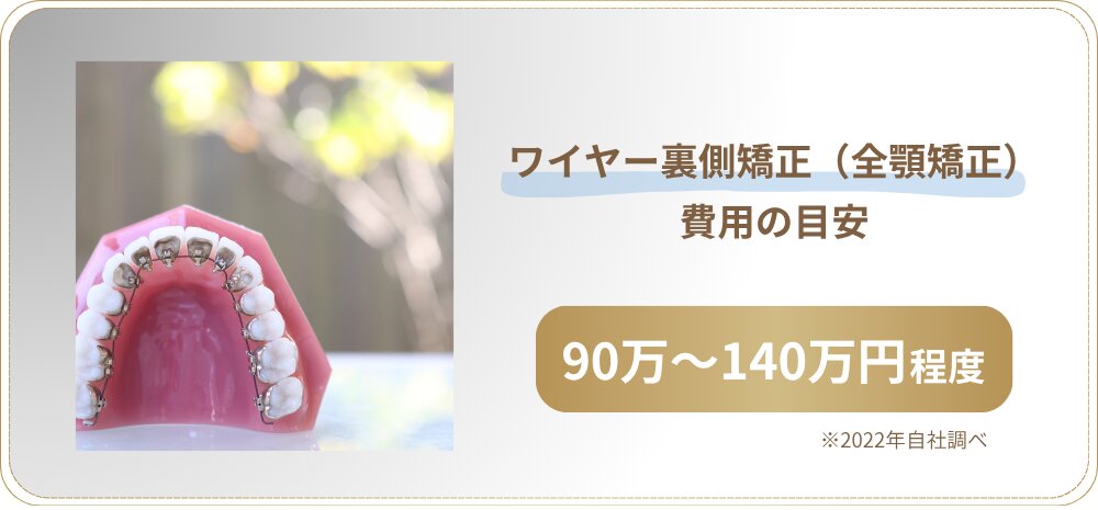 ワイヤー裏側矯正（全顎矯正）の費用の目安