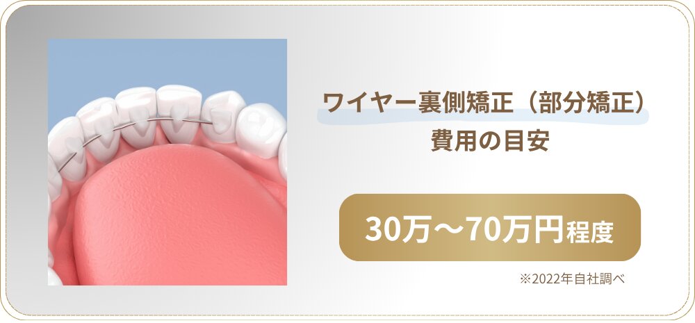 ワイヤー裏側矯正（部分矯正）の費用の目安