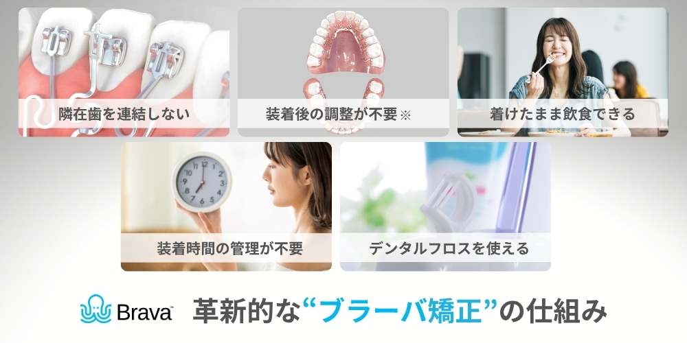 ブラーバ矯正の特徴とメリット