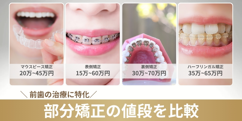 部分矯正の平均的な値段相場は15万円〜70万円