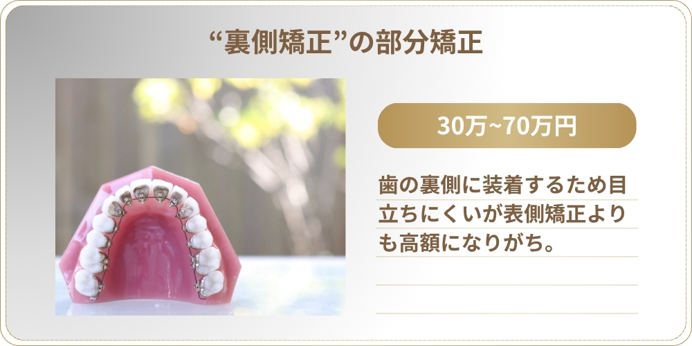 裏側矯正（舌側矯正・リンガル矯正）の部分矯正：費用相場30万円〜70万円
