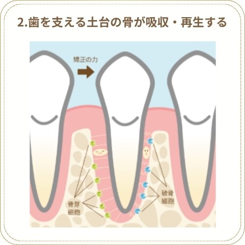 歯を支える土台の骨が吸収・再生する