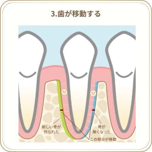 歯が移動する