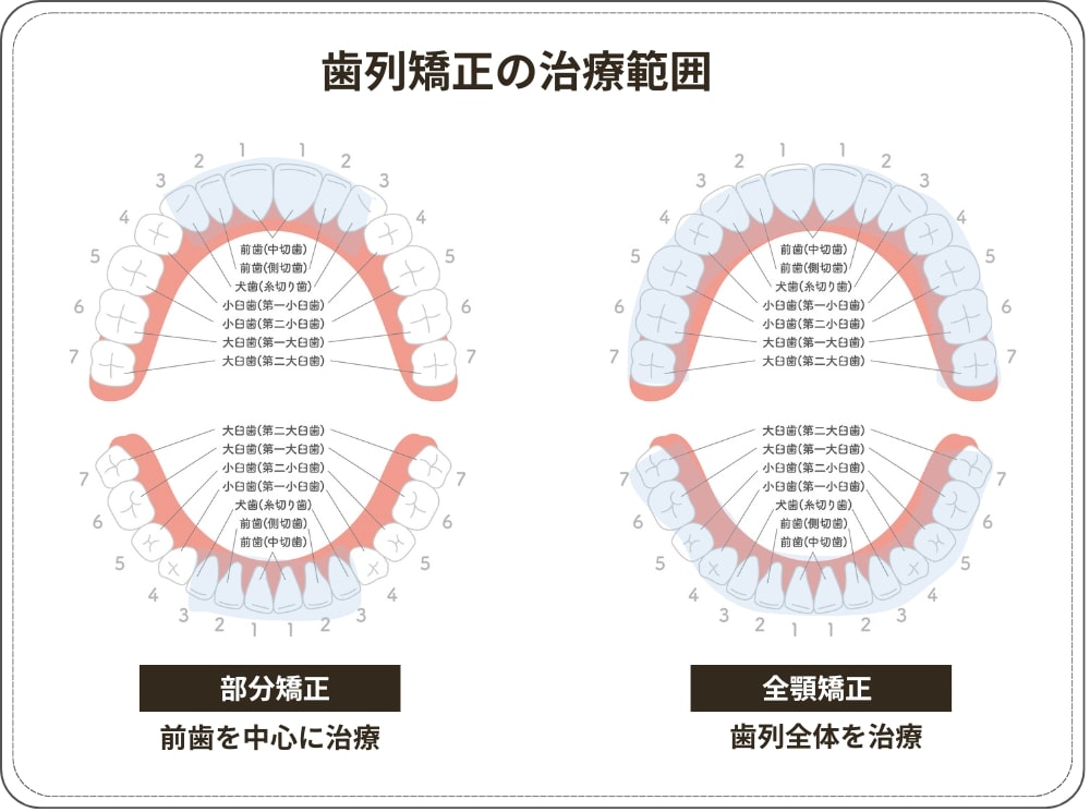 歯列矯正の治療範囲