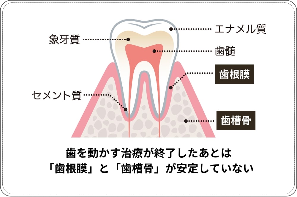 インビザライン終了後にリテーナー（保定装置）が必要な理由