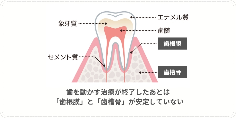 インビザライン終了後にリテーナー(保定装置)が必要な理由