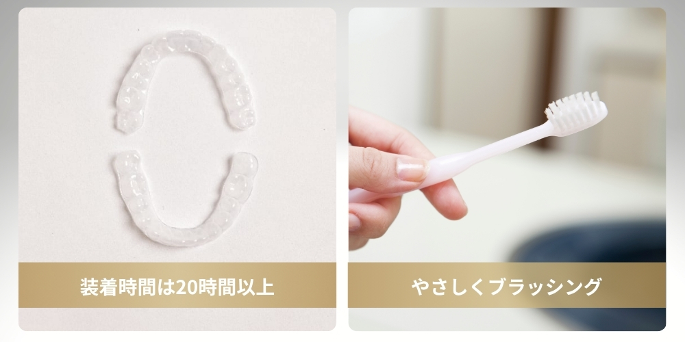 インビザラインリテーナーの使い方とお手入れ方法