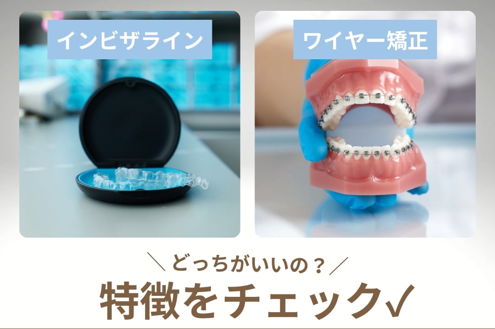 インビザラインとワイヤー矯正どっちがいいの!?