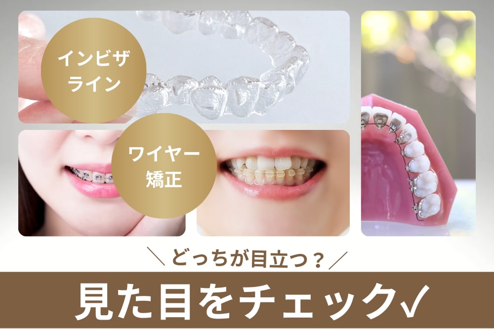 インビザラインとワイヤー矯正どっちが目立たない?