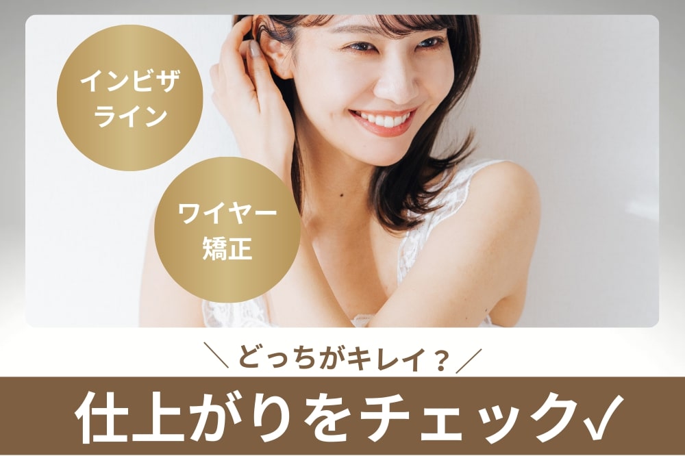 インビザラインとワイヤー矯正どっちがキレイになる?