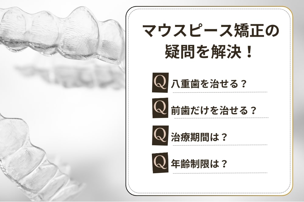 【Q＆A】できる？できない？マウスピース矯正の質問集