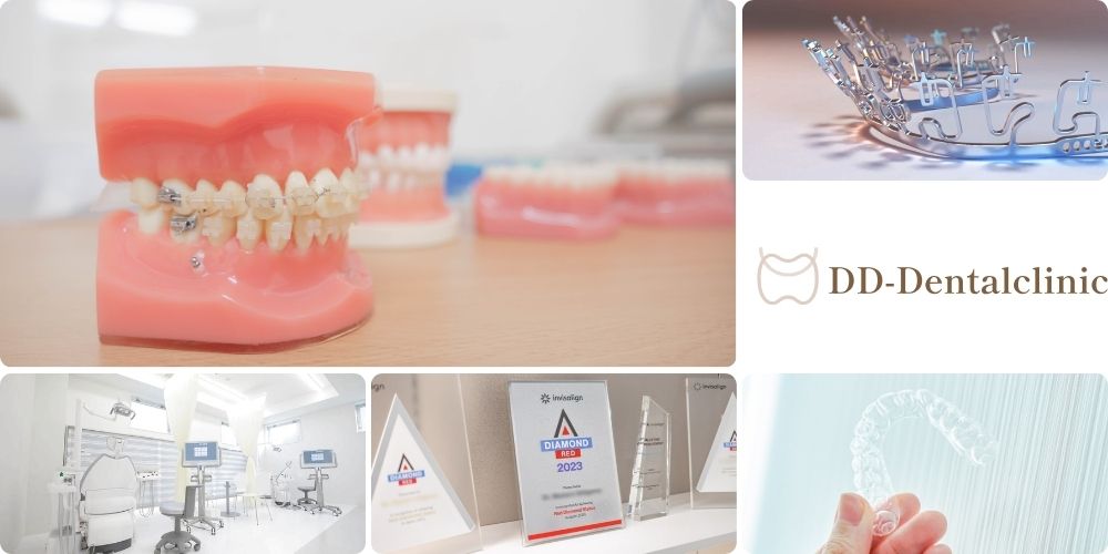 DDデンタルのすきっ歯矯正治療