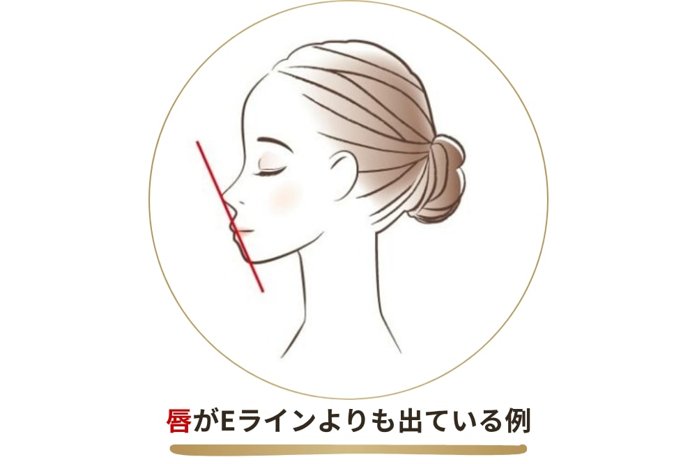 Eラインが整った日本人は少ない?人種特有の理由