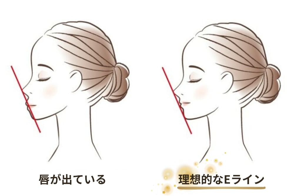 どうしたら理想のEラインになれる?