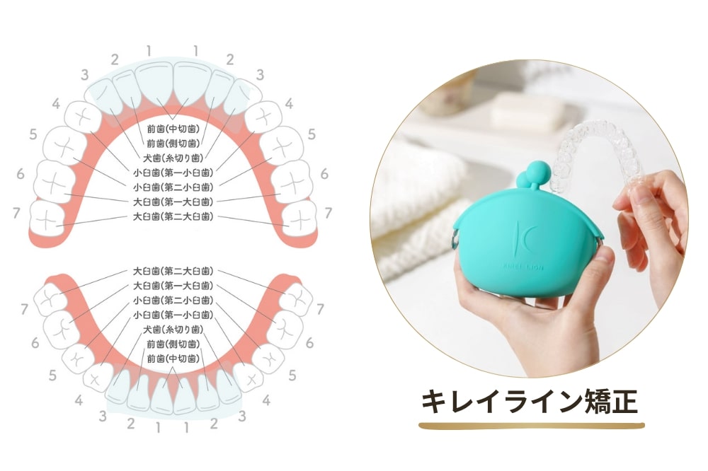 部分矯正｜キレイライン矯正