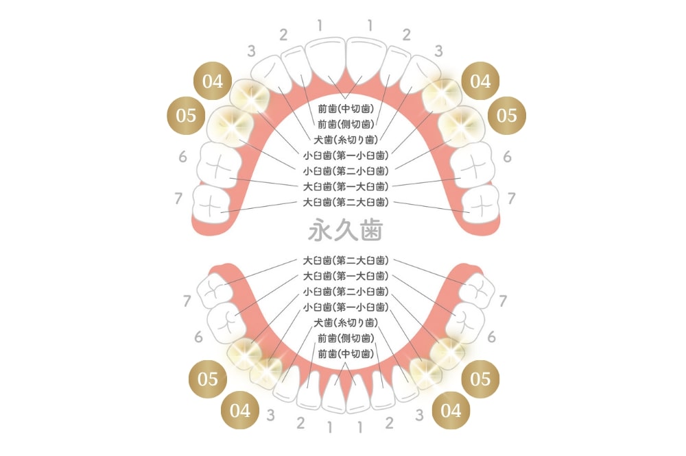 抜歯矯正になったときに抜く歯