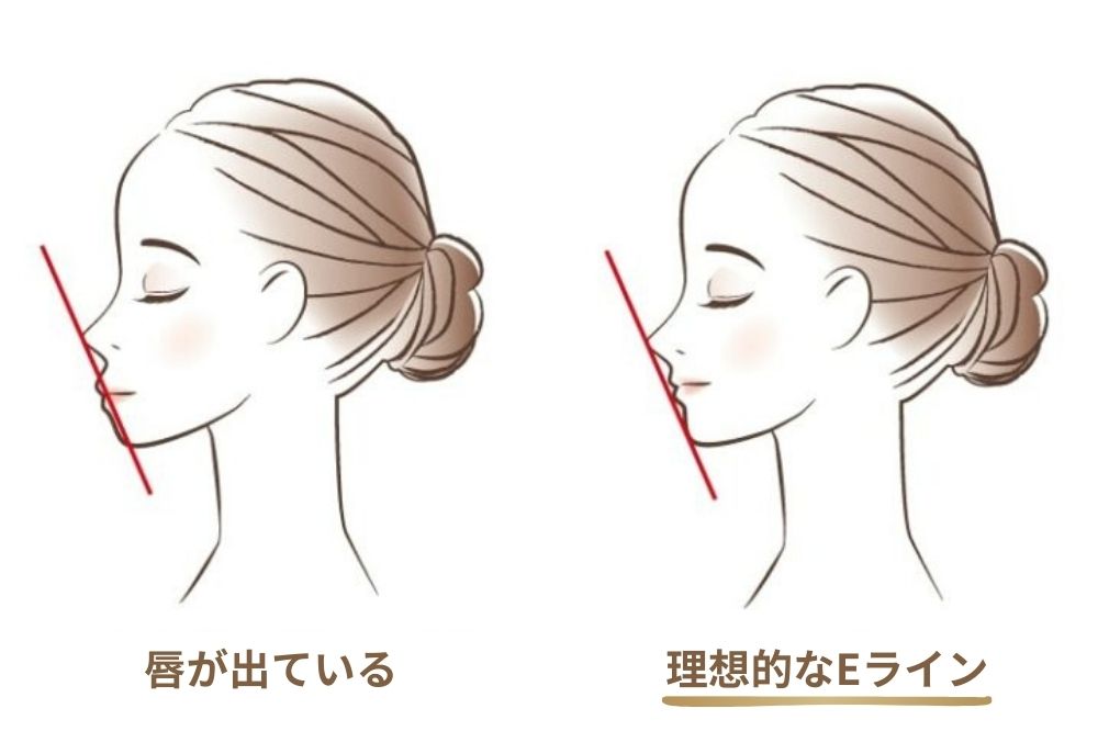  Eラインが整い横顔が美しく見える