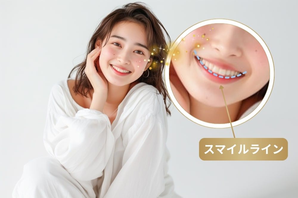 スマイルラインが整い自然で美しい笑顔が作れる