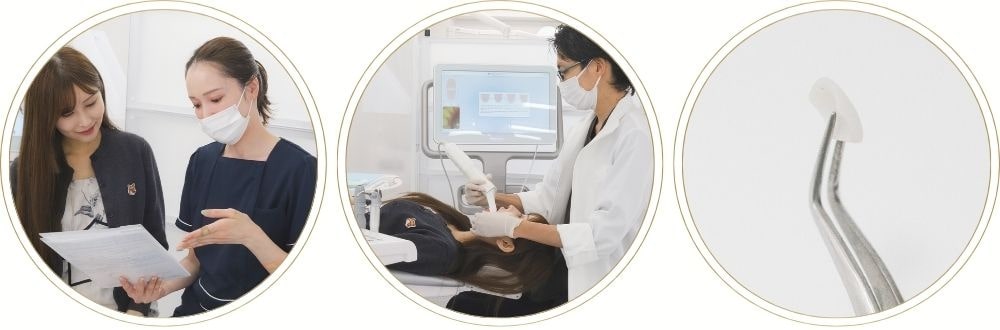 ラミネートベニアの治療の流れ