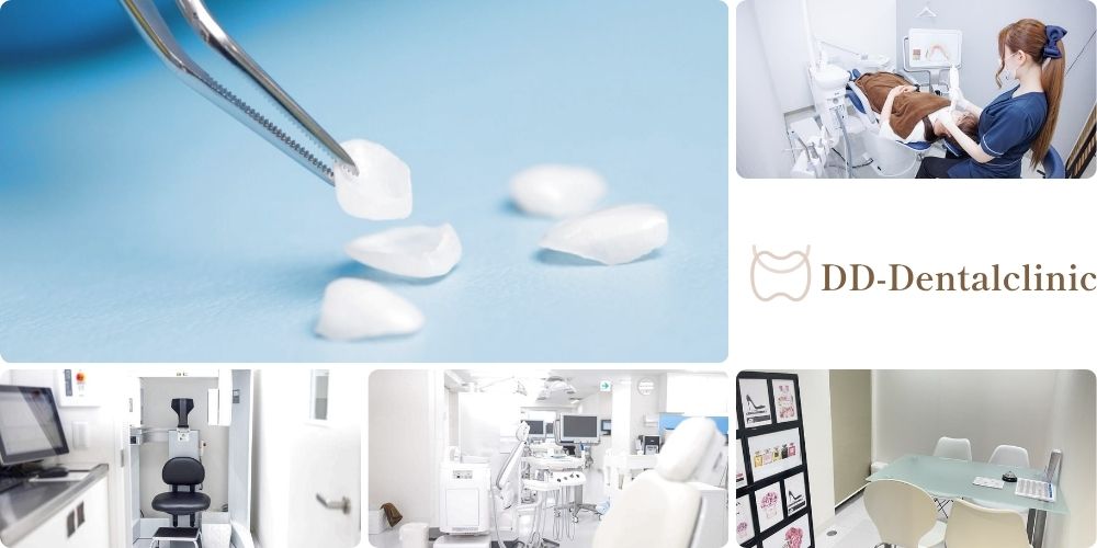 DDデンタルクリニックの削らないラミネートベニア