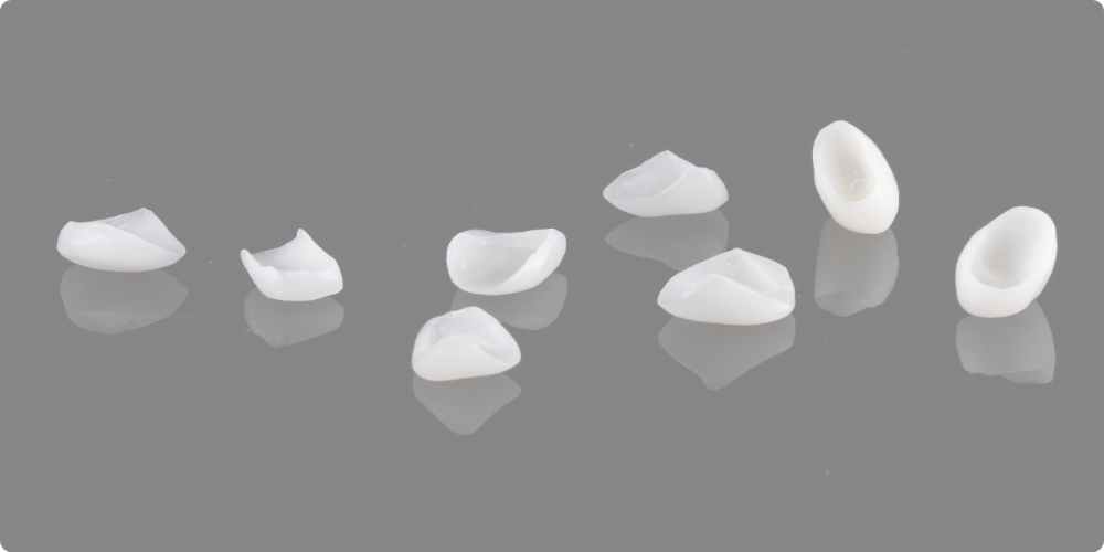 ラミネートベニアは短期間で前歯を美しく整えられる方法