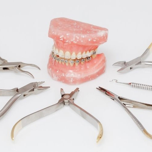 ワイヤー矯正の値段（費用）はいくらかかる？種類別の相場や料金内訳を解説