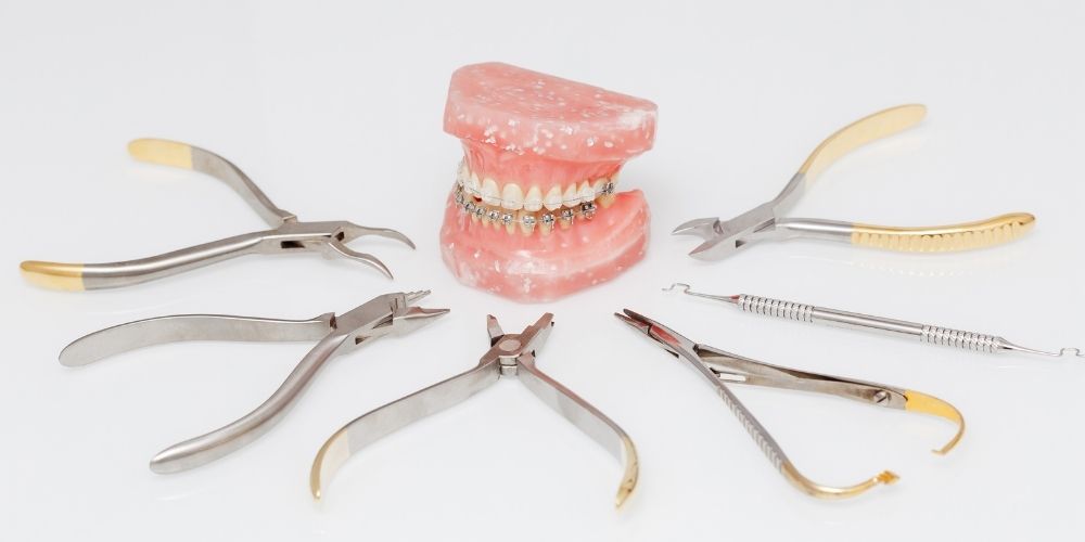 ワイヤー矯正の値段（費用）はいくらかかる？種類別の相場や料金内訳を解説