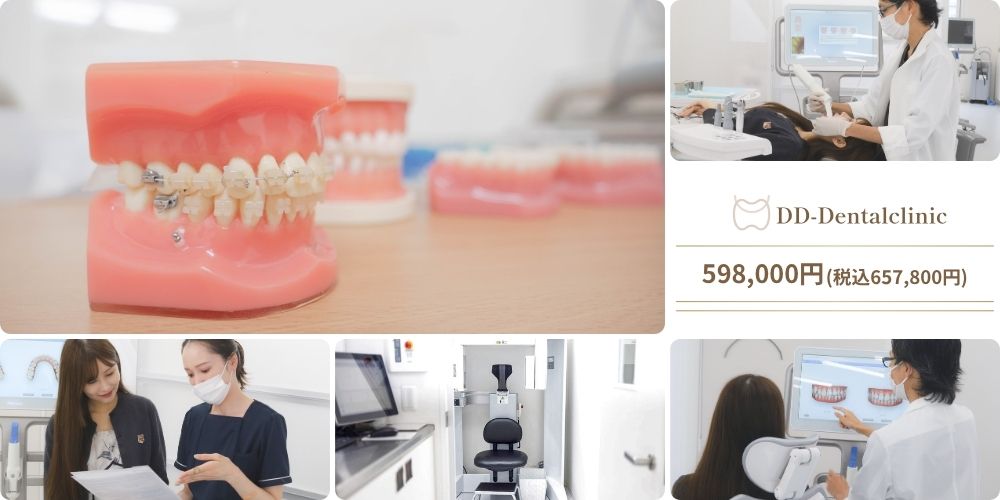 DDデンタルクリニックの「審美ワイヤー矯正」は、598,000円（税込657,800円）