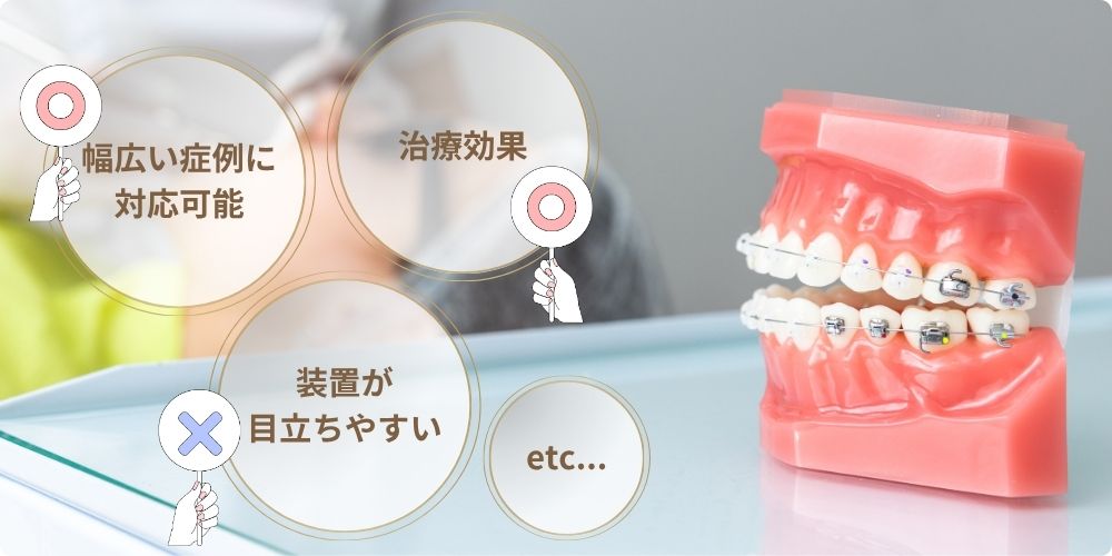 ワイヤー矯正の特徴とメリット・デメリット