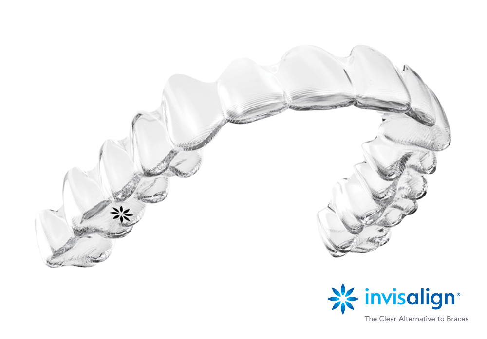 インビザラインのアライナー