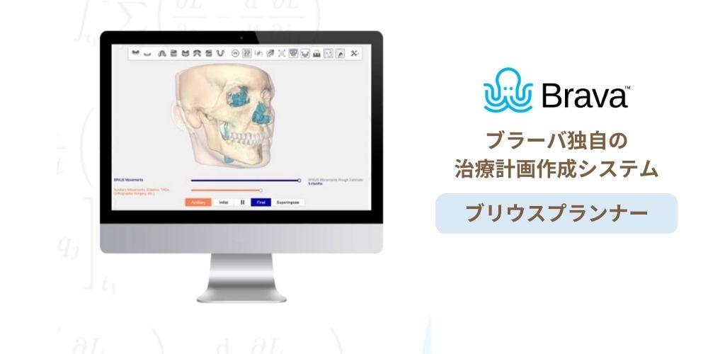 ブラーバ独自の治療計画作成システム「ブリウスプランナー」