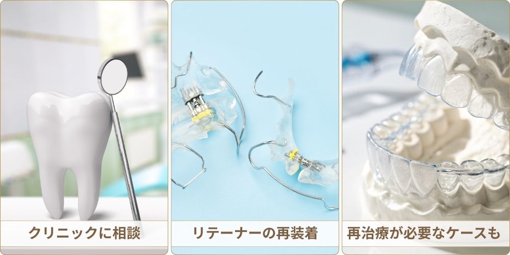 矯正後に後戻りしたときの正しい対処法