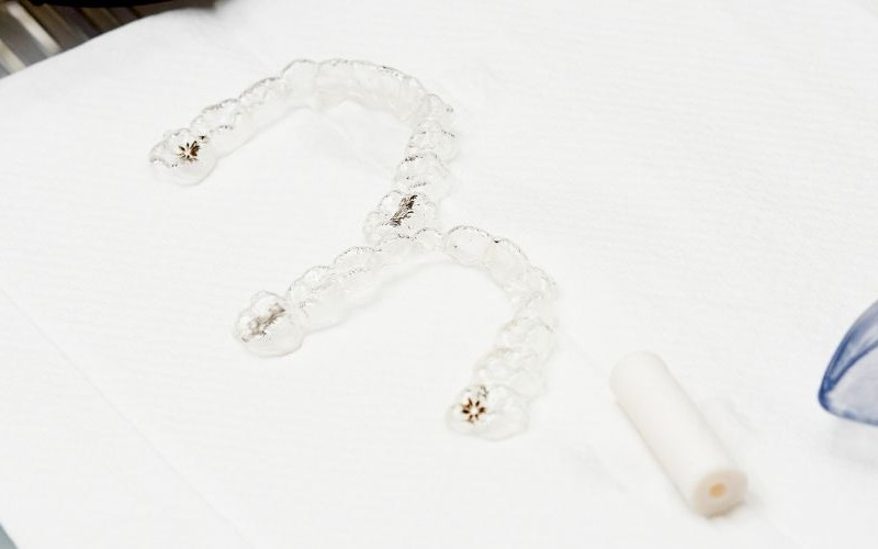 インビザラインGoとは？通常のインビザラインとの違い・向いている人を解説