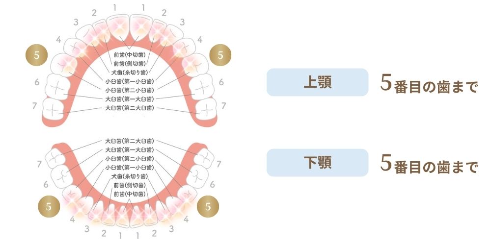インビザラインGoとは
