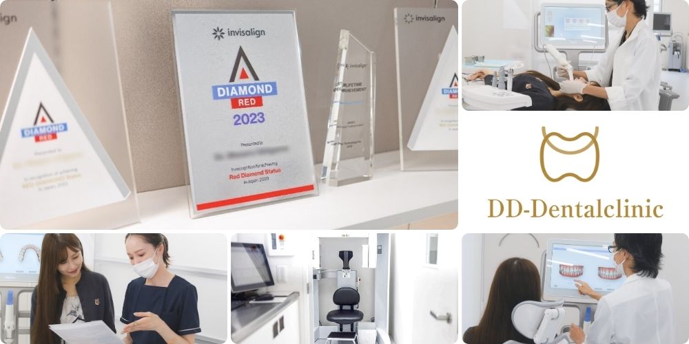 インビザラインGo（マウスピース部分矯正）が可能か矯正歯科で相談してみよう